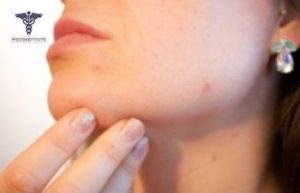 Therapy for Diseases Caused by Microbes